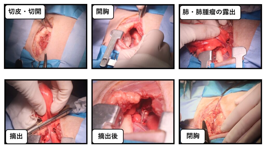肺腫瘤の実際の手術写真