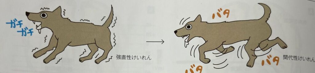全般発作の症状