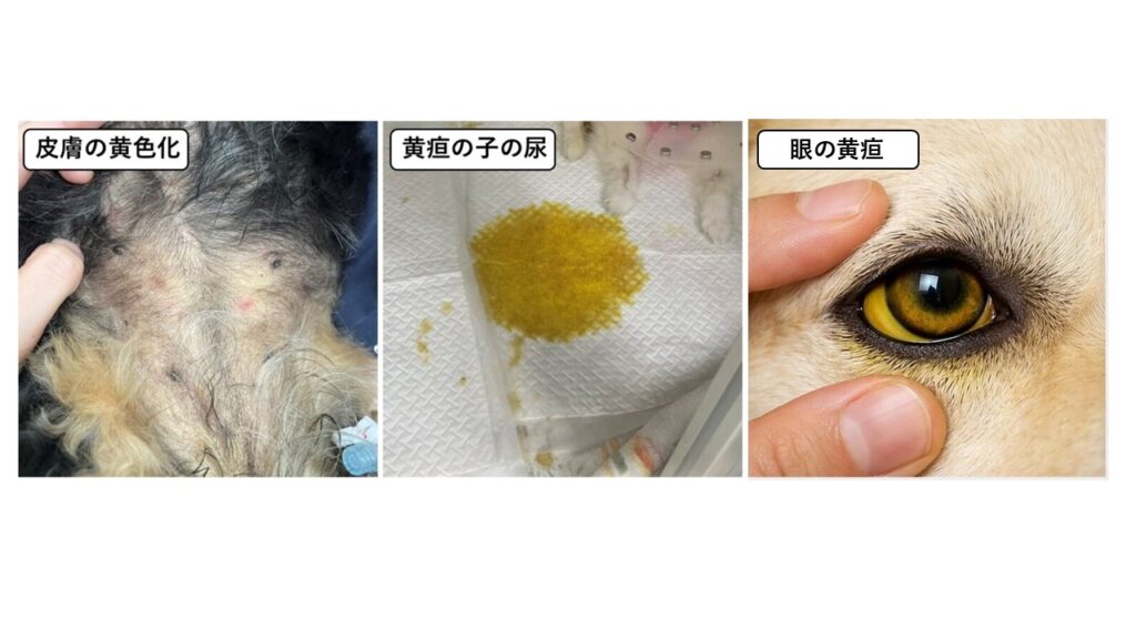 実際の黄疸症例の写真