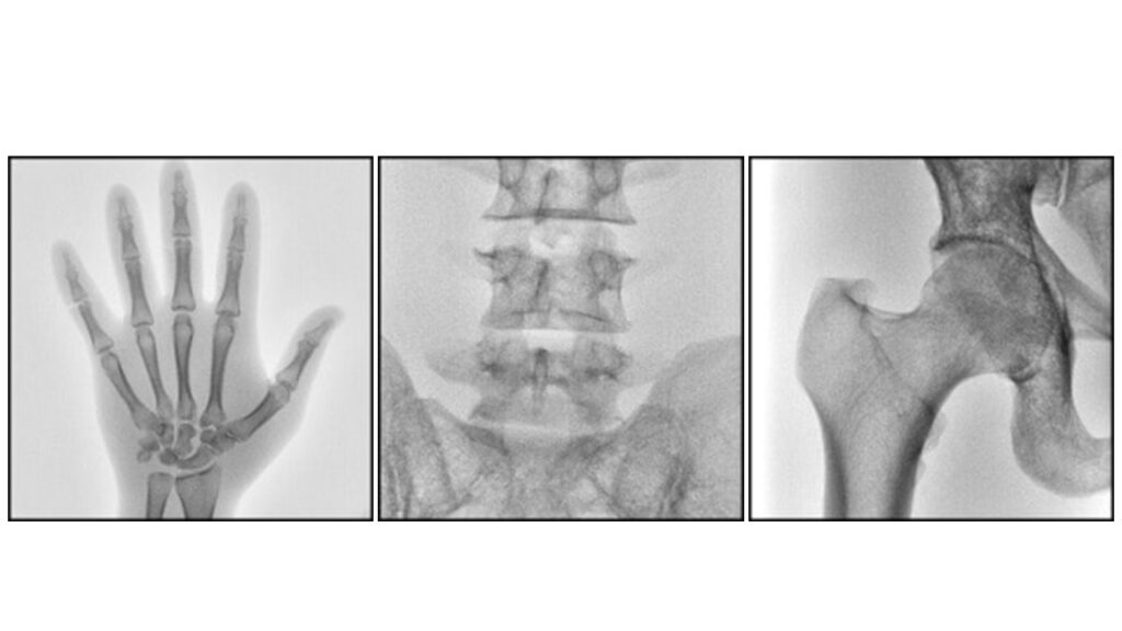 Cアームでの撮影画像
