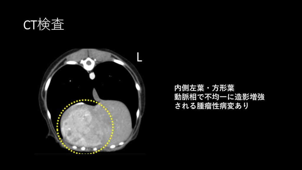 CT検査結果