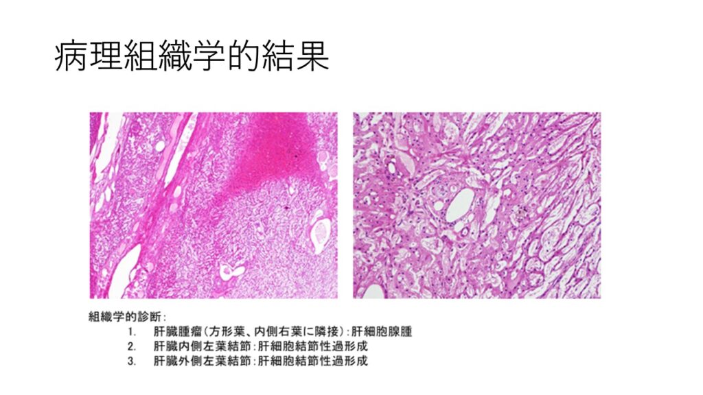 病理組織学的検査結果