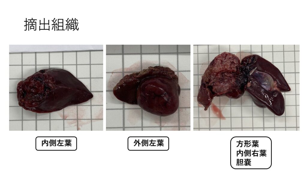 摘出組織