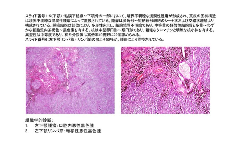 病理学的検査の結果