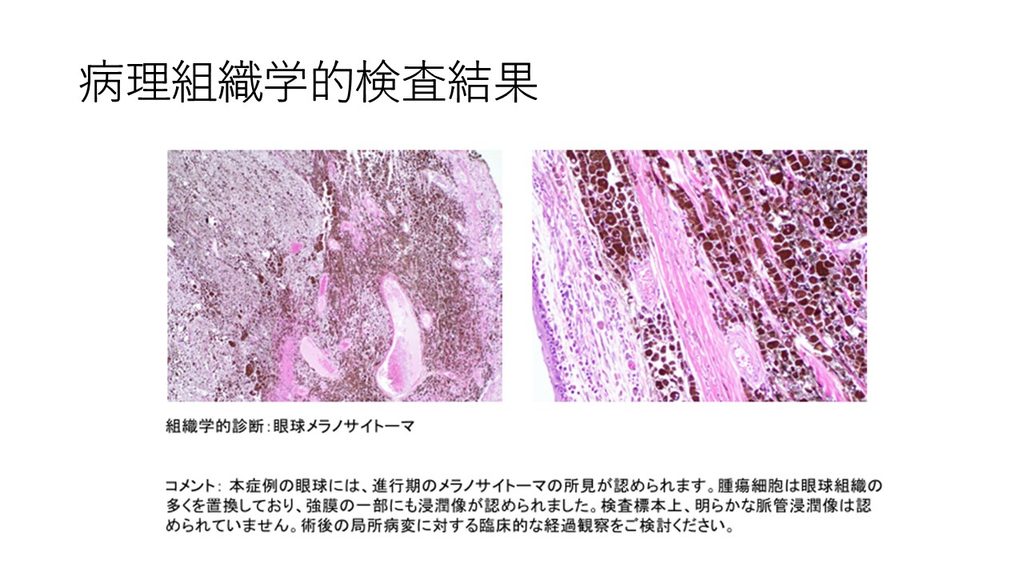 病理組織学的検査の結果